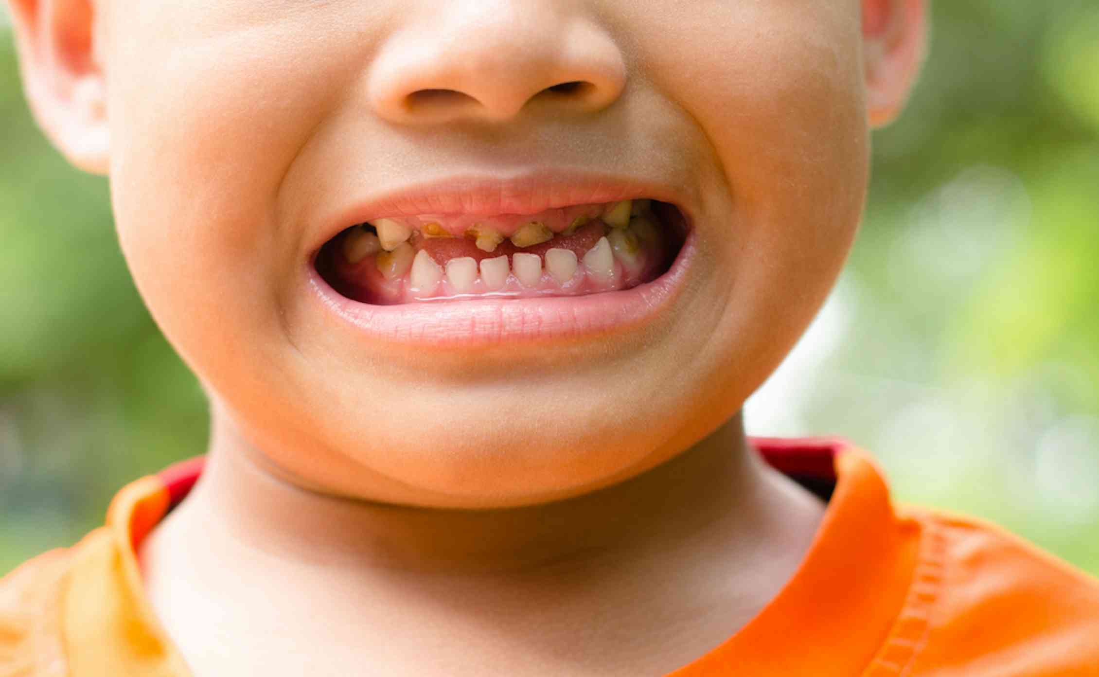 Ребенок без молочных зубов