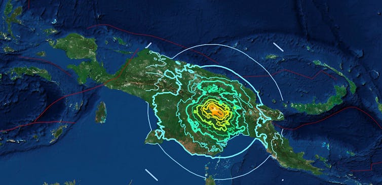 File 20180306 146655 nxayso.jpeg?ixlib=rb 1.1