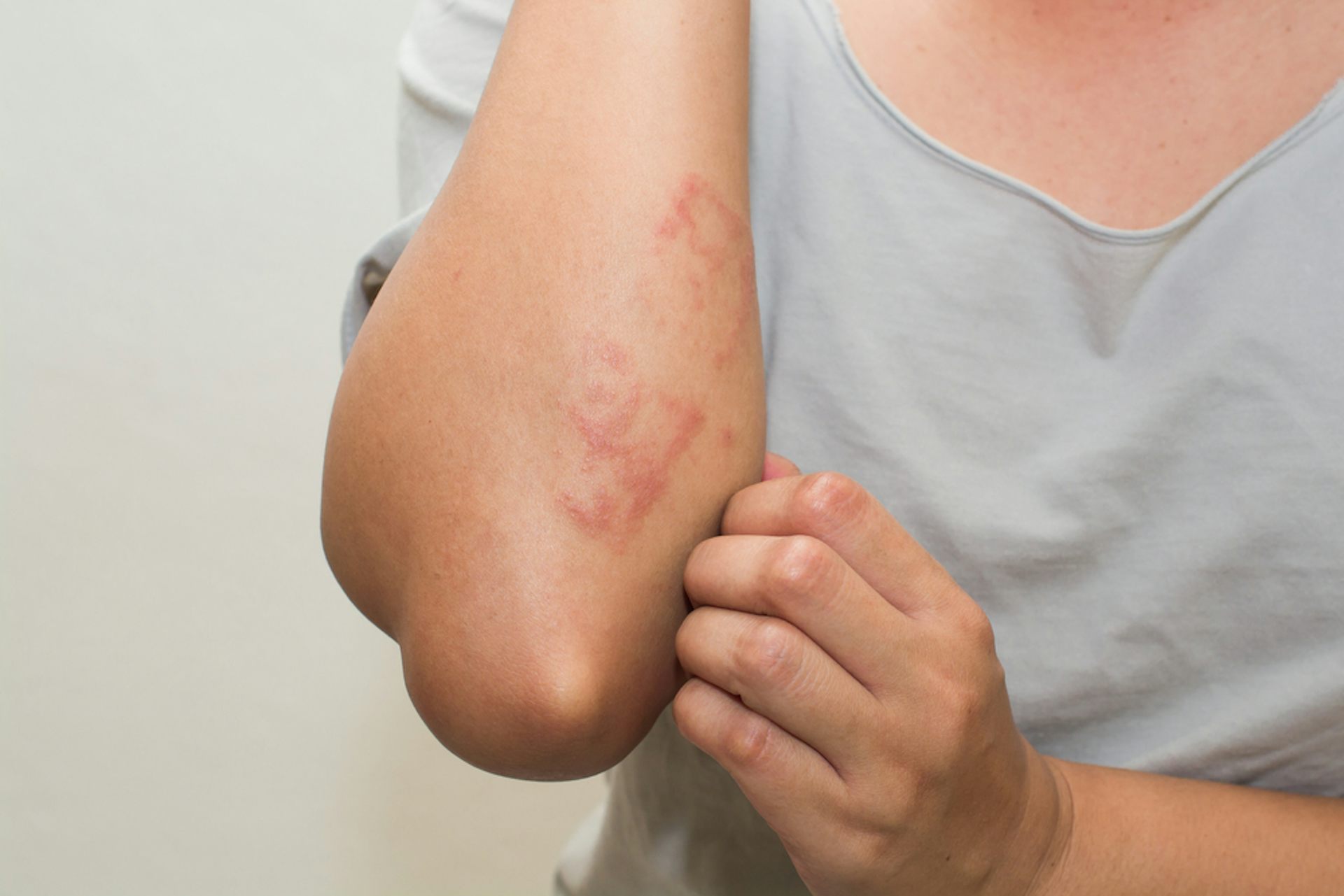 dog allergy skin rash