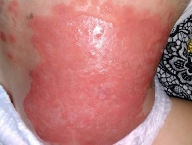 Four of the most life-threatening skin conditions and what you should know about them
