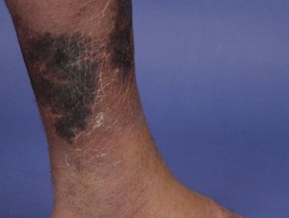 Four of the most life-threatening skin conditions and what you should ...