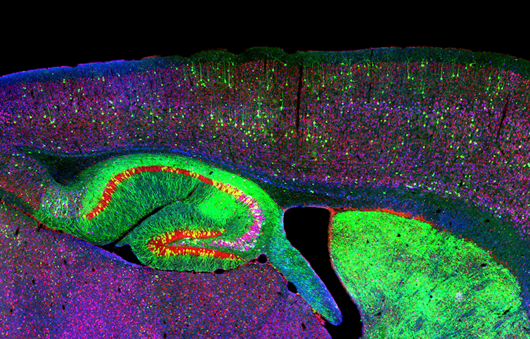 Where does the controversial finding that adult human brains don't grow new neurons leave ongoing research?