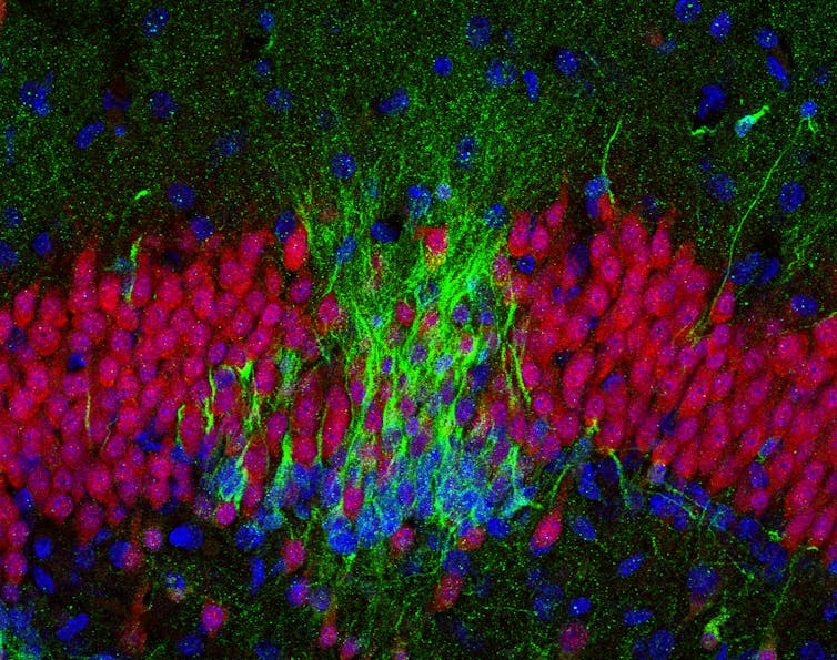 Where does the controversial finding that adult human brains don't grow new neurons leave ongoing research?