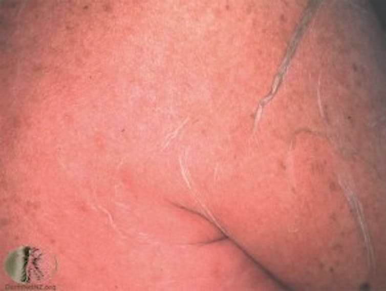 Four of the most life-threatening skin conditions and what you should know about them