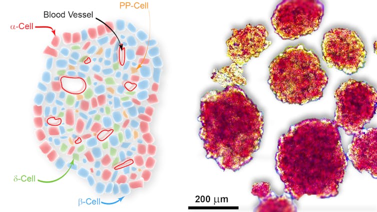 We've made 'smart egg-cartons' to transport cells to cure diabetes