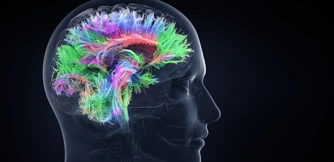 Image result for fMRI