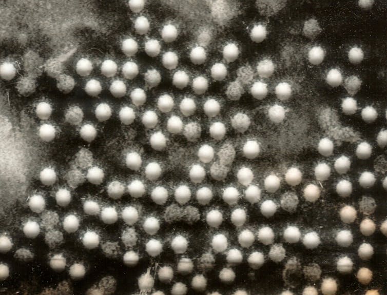 Microscopic image of polioviruses