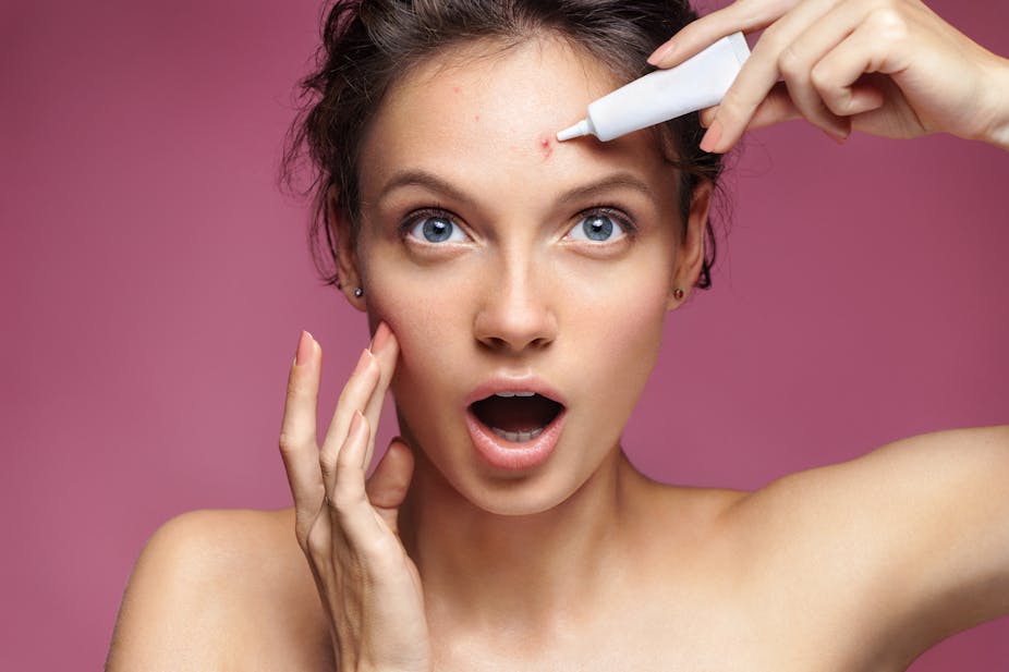 Pimples - Why the beauty industry will never fully embrace spots ...