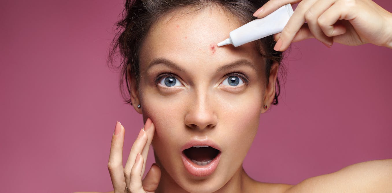 Why the beauty industry will never fully embrace spots  Why the beauty industry will never fully embrace spots