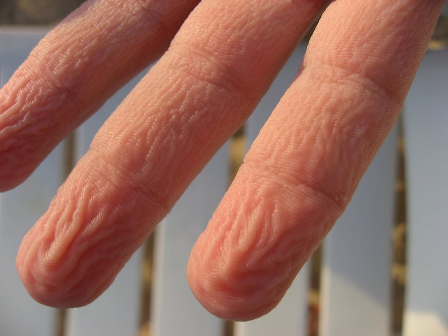 Why Do Fingers Prune?, TS Digest