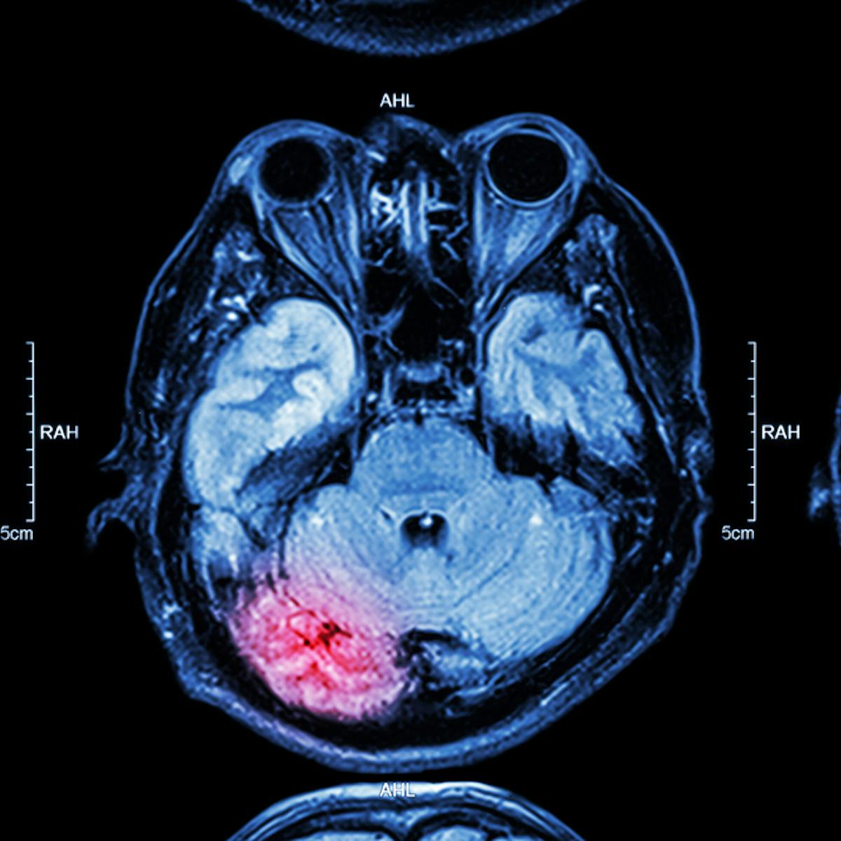 How Injuries Change Our Brain And How We Can Help It Recover How Injuries Change Our Brain And How We Can Help It Recover