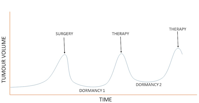 Graph showing 'Tumour volume' on the vertical axis and 'time' on the horizontal axis. In the middle of the graph there are arrows pointing to surgery, therapy and therapy. 