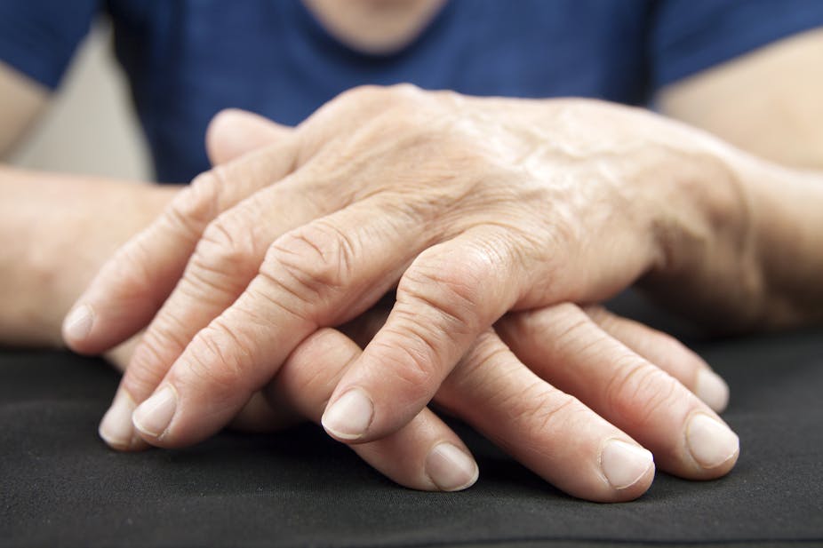 arthritis en español | Diccionario Húngaro-Español | Glosbe
