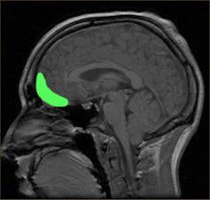 Orbitofrontal cortex location. 