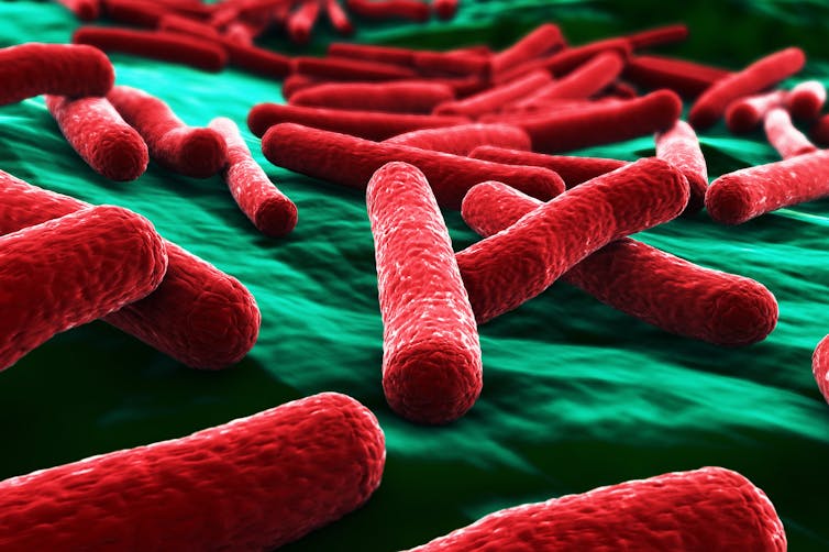 File 20180424 94157 1hsgfxd.jpg?ixlib=rb 1.1