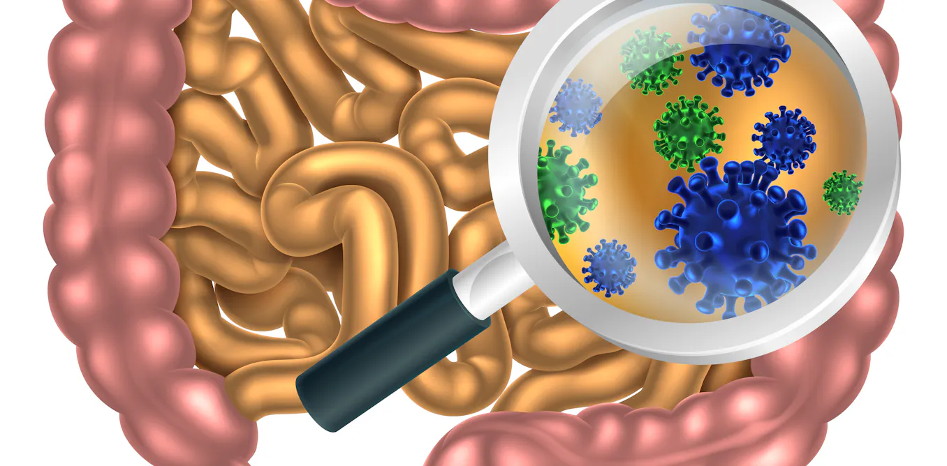 Contaminated Poop Studying poop samples, scientists find clues on health and disease
