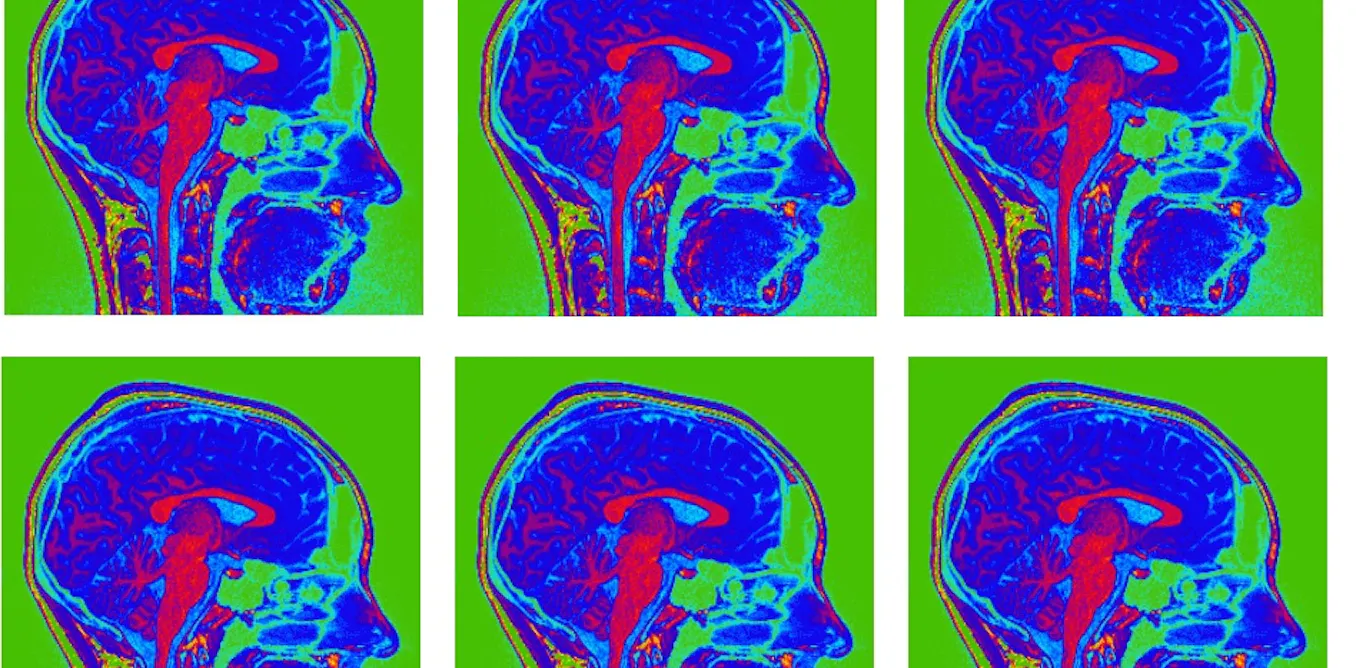 Is it rational to trust your gut feelings? A neuroscientist explains Is it rational to trust your gut feelings? A neuroscientist explains