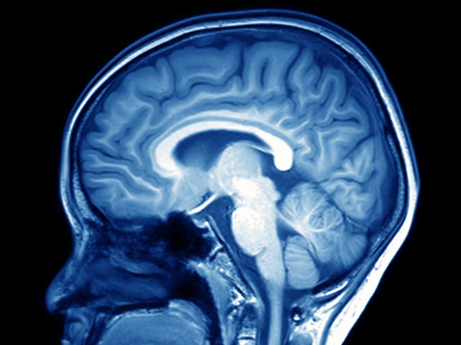Why do humans have such large brains? Our study suggests ecology was