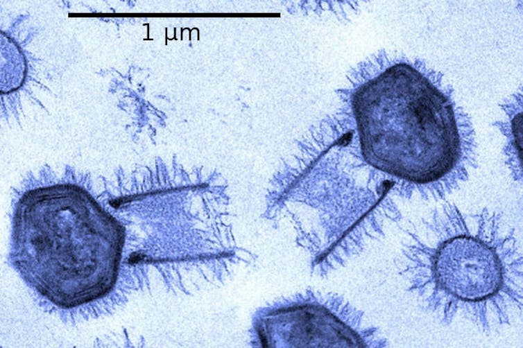 viruses can cause global pandemics but