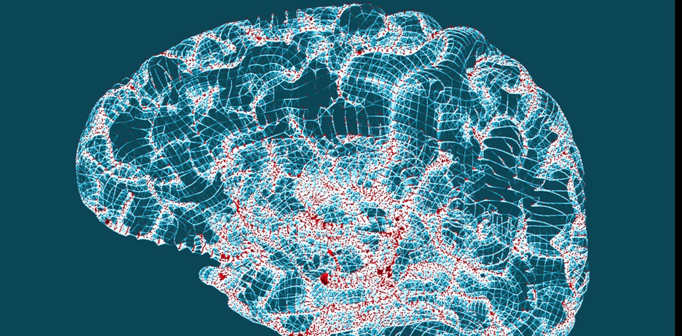 Alzheimer’s disease: why insulin is a new suspect