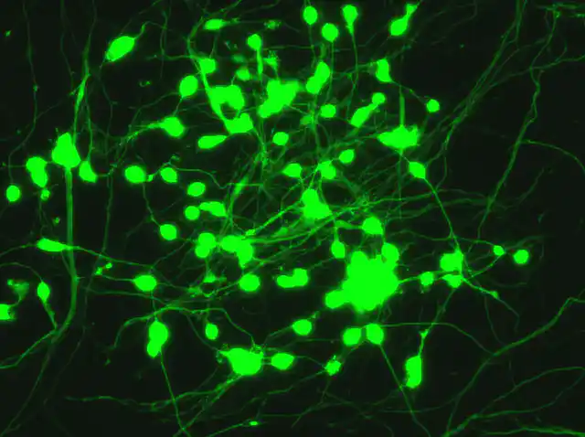 Neuron Repeating Pattern Neuron Pattern