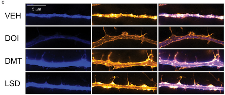 Mind molding psychedelic drugs could treat depression, and other mental illnesses