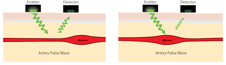 heart-rate monitors