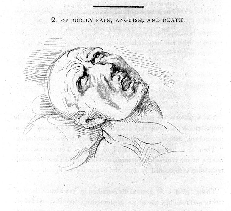 Opiate Addiction and the History of Pain and Race in the U.S. Opiate Addiction and the History of Pain and Race in the U.S.