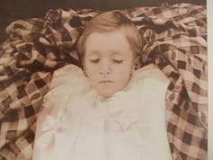 A deceased young girl is seen at a concentration camp where the British housed Boer women and children during the Second Anglo-Boer War of 1899-1902