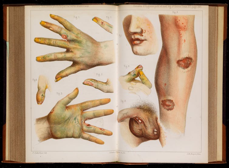 green arsenic poison effects