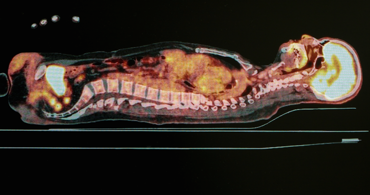 Having a scan? Here’s how the different types work and what they can find