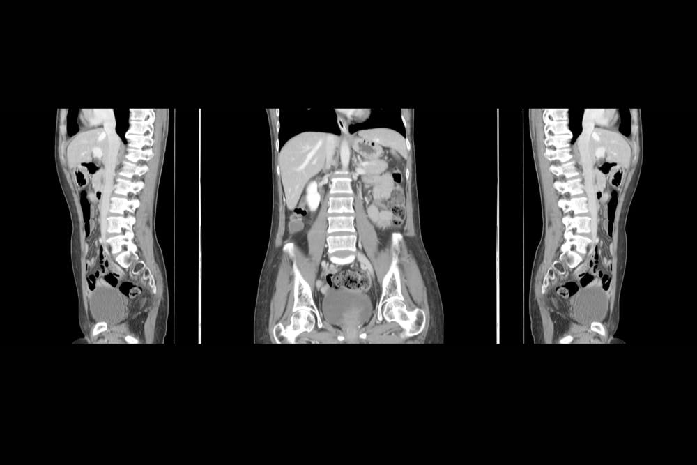 Having A Scan Here S How The Different Types Work And What They Can Find