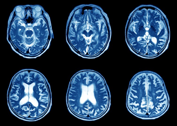 Having a scan? Here’s how the different types work and what they can find