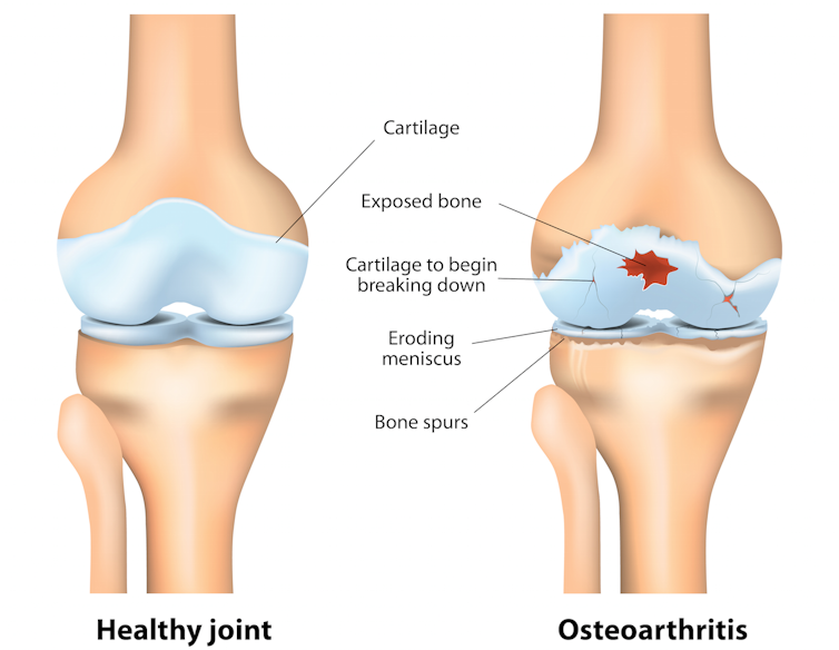 is glucosamine good for joints?