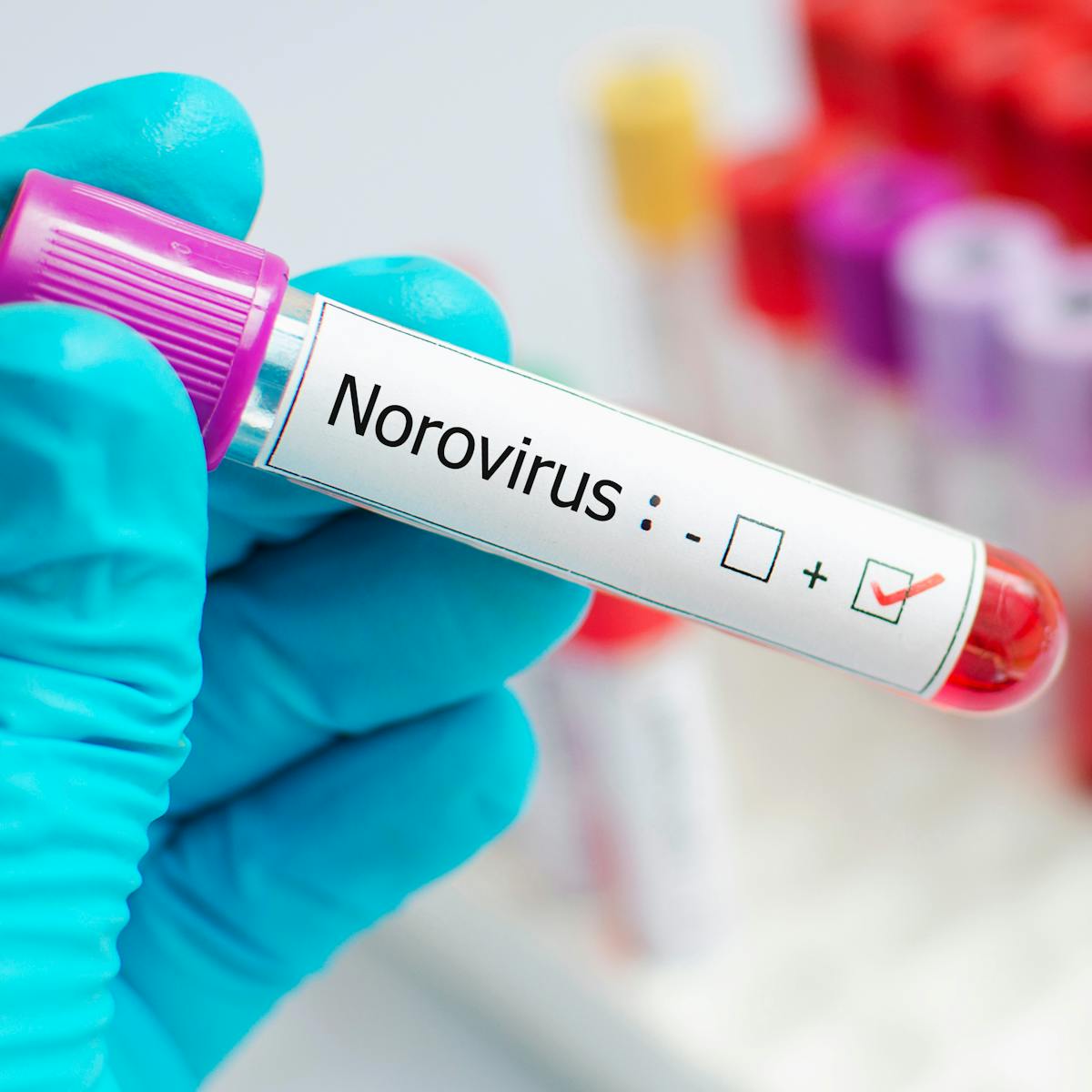 Norovirus: a summer outbreak could lead to a winter crisis Norovirus: a summer outbreak could lead to a winter crisis