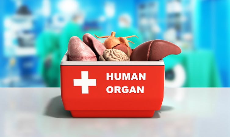 ÎÏοÏÎλεÏμα εικÏÎ½Î±Ï Î³Î¹Î± Transplant Tourism equals murder in some countries