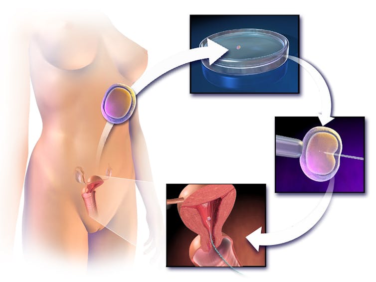 40 years after the birth of IVF, researchers push boundaries to preserve fertility in women, men and children