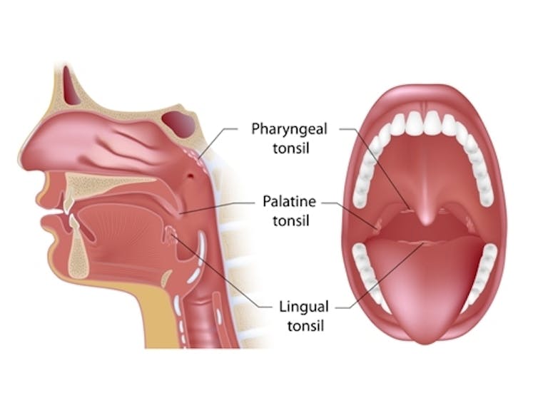 Why do we have tonsils?????