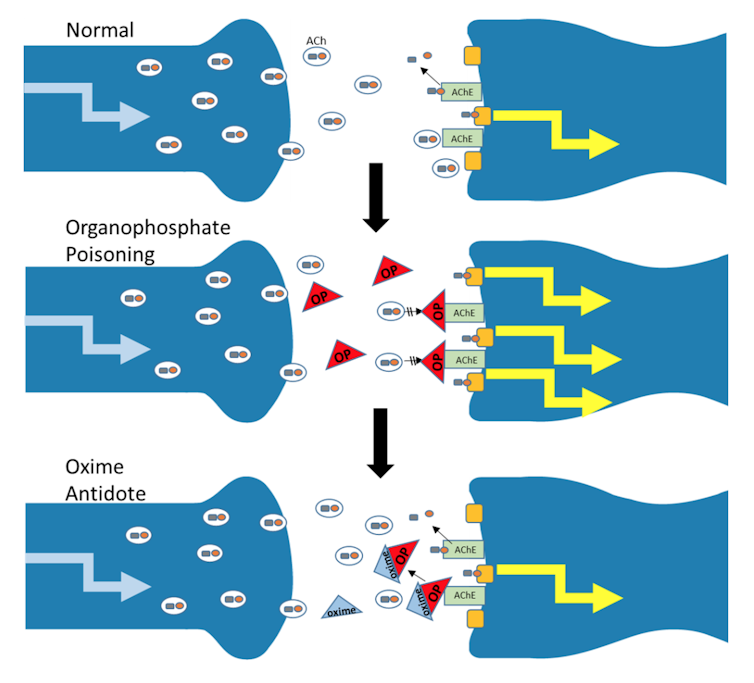 Saving the brain with a new nerve agent antidote