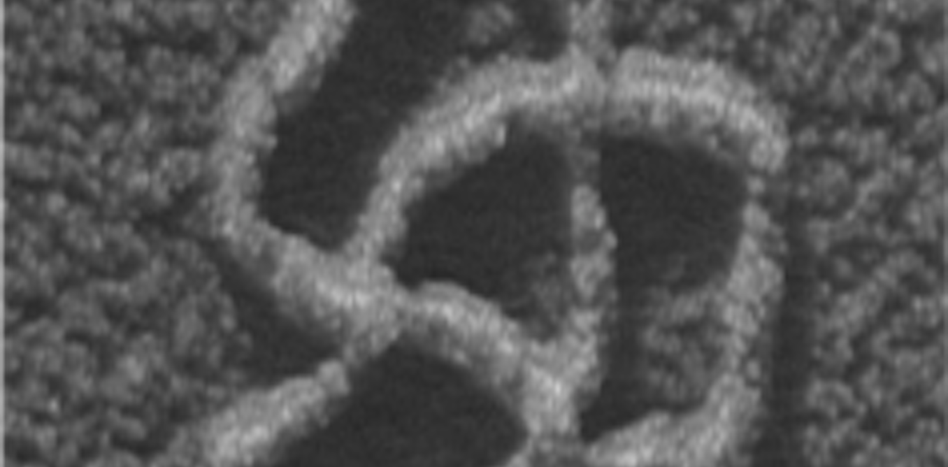 Math shows how DNA twists, turns and unzips