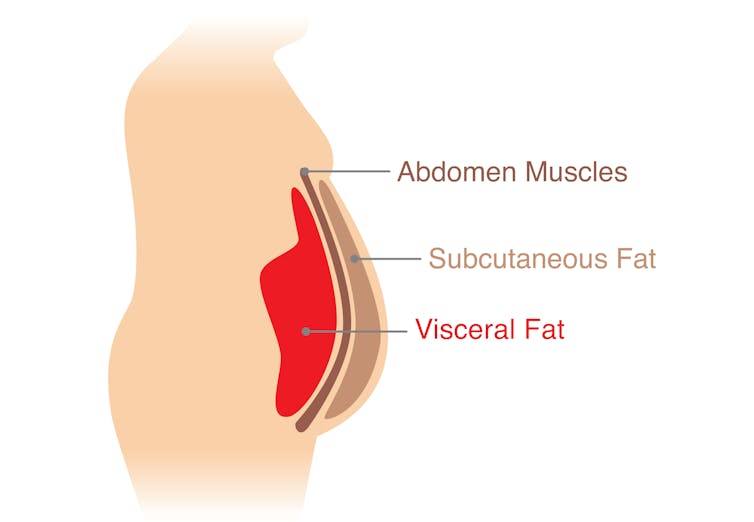 The fat around the organs is a different kind of fat. (shutterstock)
