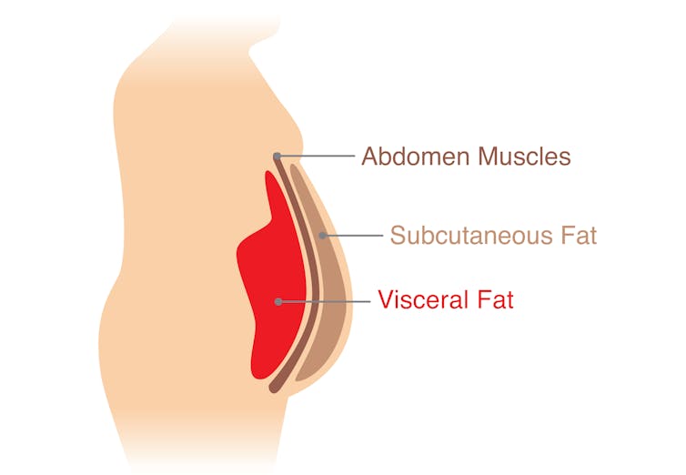 Belly fat is the most dangerous, but losing it from anywhere helps