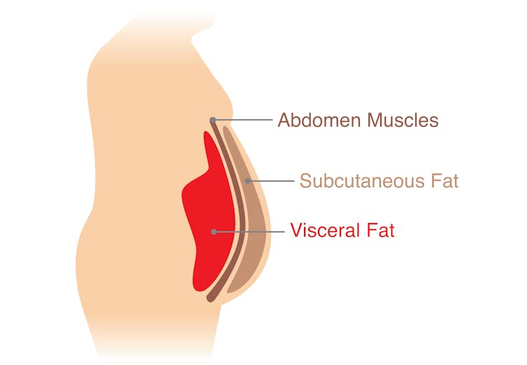 Belly fat is the most dangerous, but losing it from anywhere helps