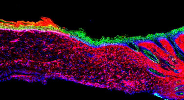 cross-section of regenerated skin with different cell types 