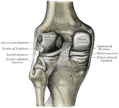 knee arthroscopy is one of the most common but least effective surgeries