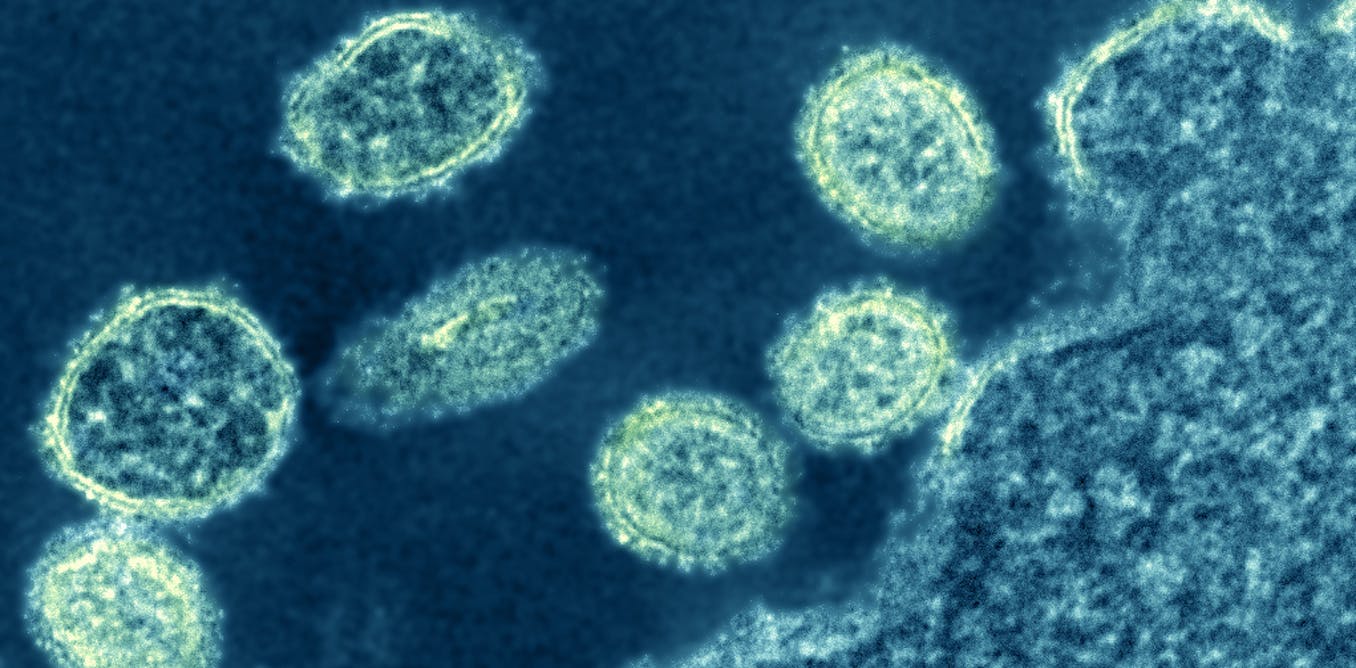 influenza pandemic deadly why