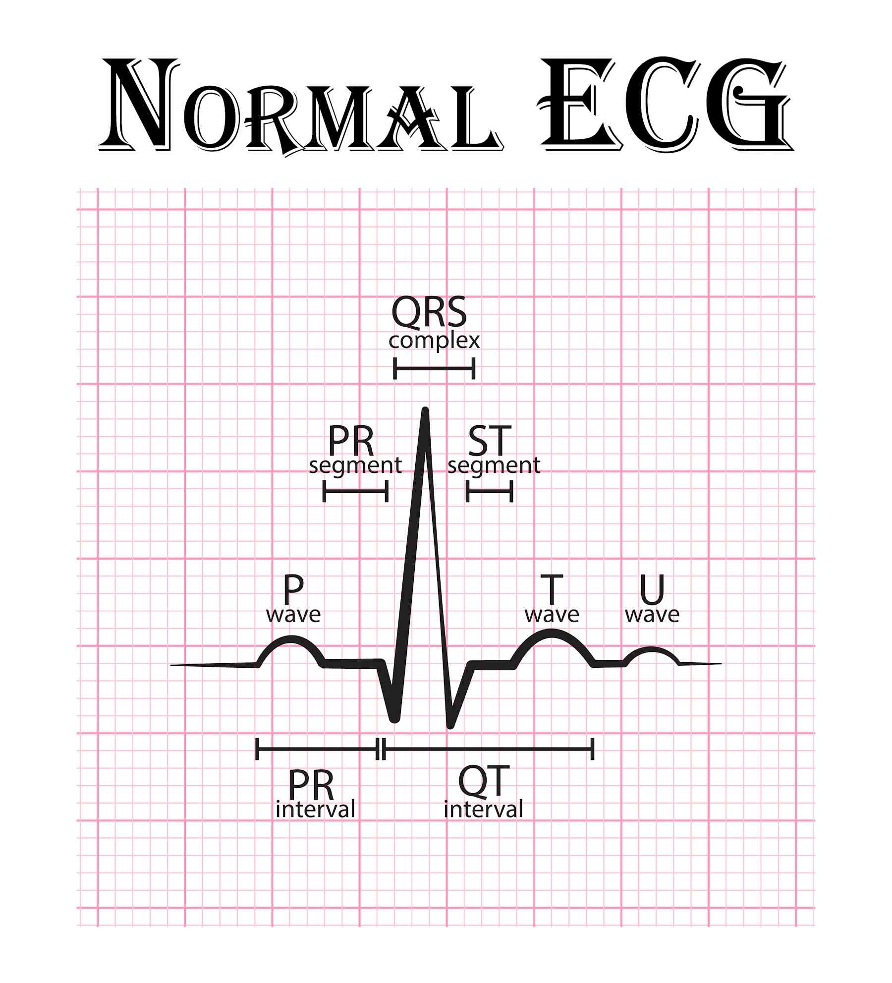 what-is-a-ekg-images-and-photos-finder