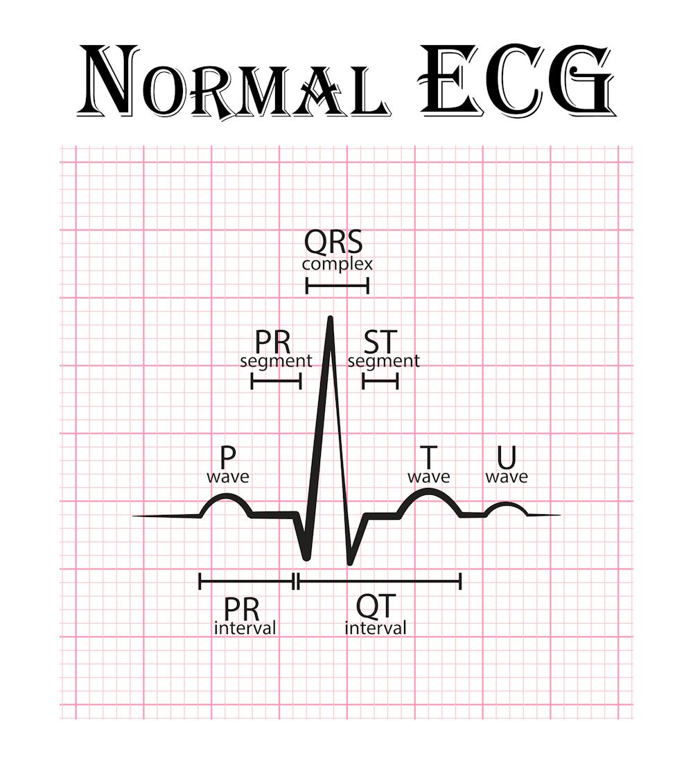 Your Apple Watch Can Now Record Your Ecg But What Does That Mean And Can You Trust It