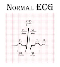 Your Apple Watch can now record your ECG – but what does that mean and can you trust it?