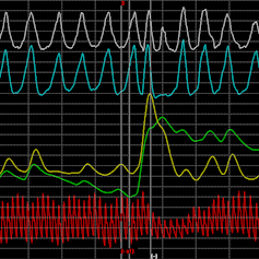 Is a polygraph a reliable lie detector?